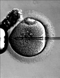 Dna Testing In Vitro Fertilisation Baby